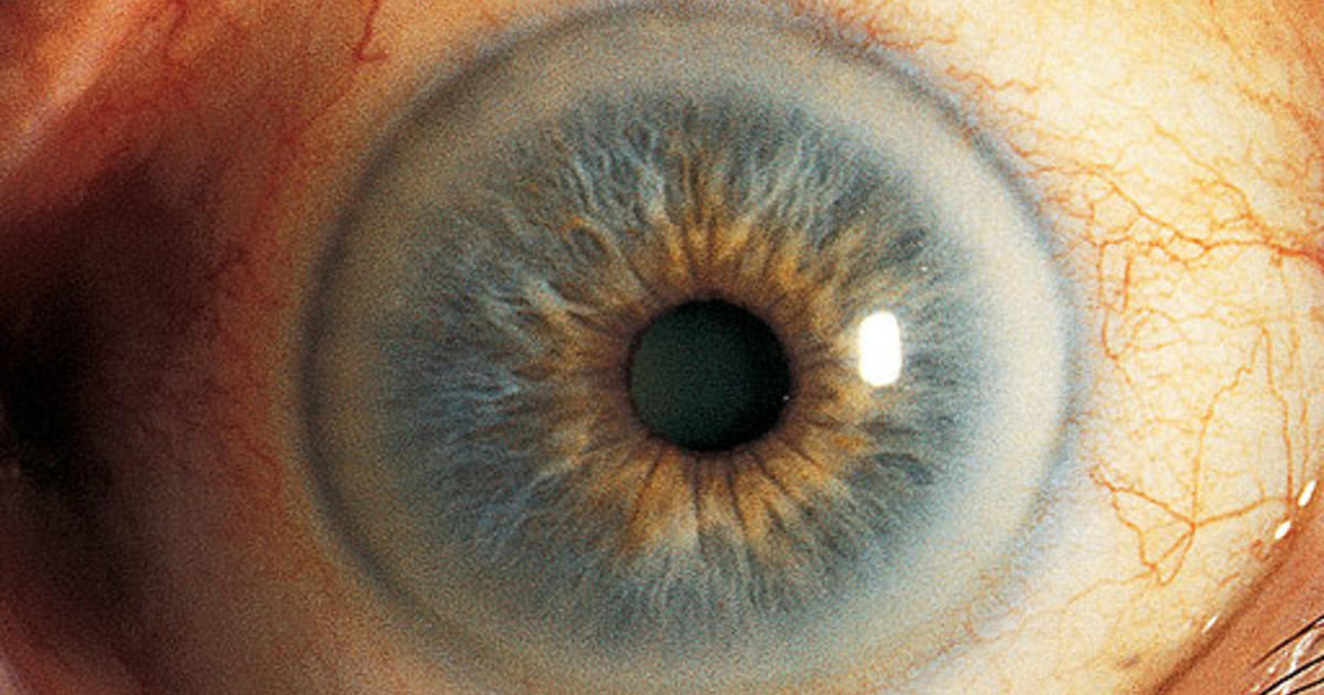 12 scary things your eyes say about your health