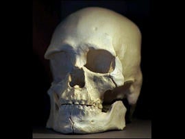 Fla. Couple Buys Real Human Skeleton at Yard Sale for $8