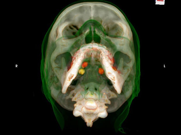 in case body body ncis a mules caught Pictures CT on Photo 1 scans Drug Busted! in case body body ncis a mules caught Pictures CT on Photo 1 scans Drug Busted!