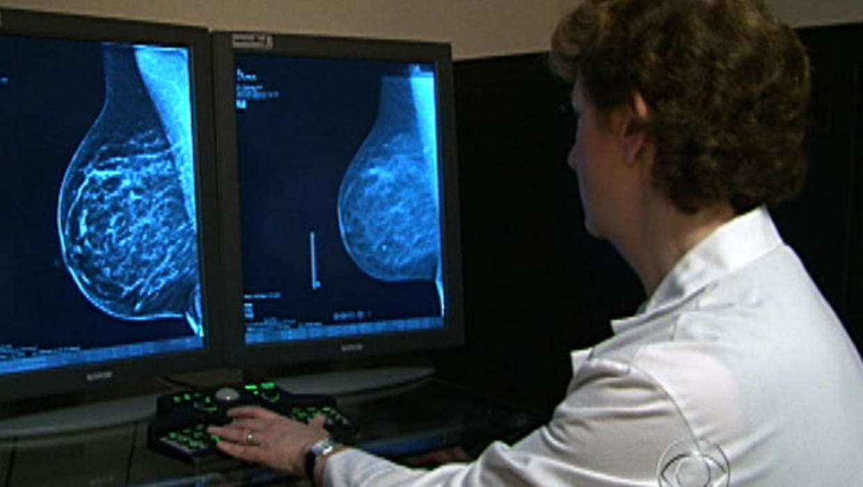 3D mammogram newest weapon against breast cancer CBS News