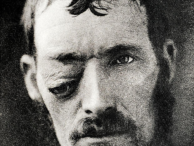 Eye care in the 1800s: 14 shocking photos 