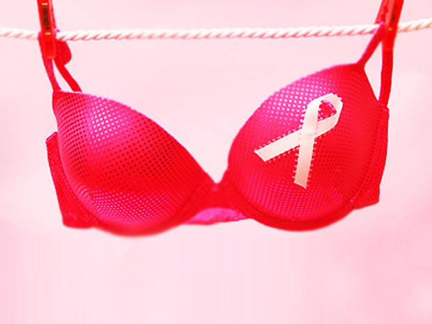 underwire bra breast cancer