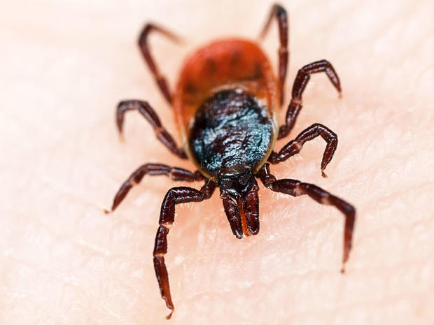 Lyme Disease Lies And Truths Cbs News