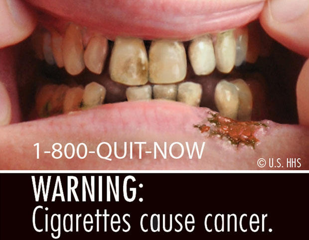 fda-cigarette-warning-labels-6.jpg 
