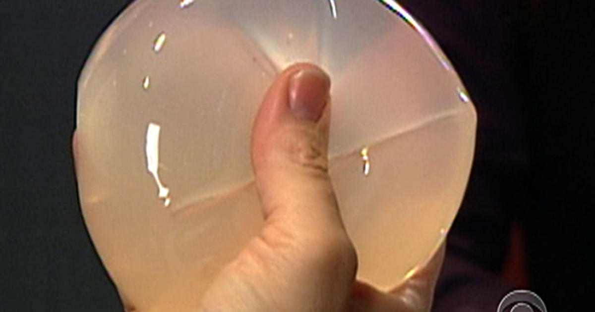 Breast Implants Safe But Dont Last Forever Fda Says What Women Need 2417