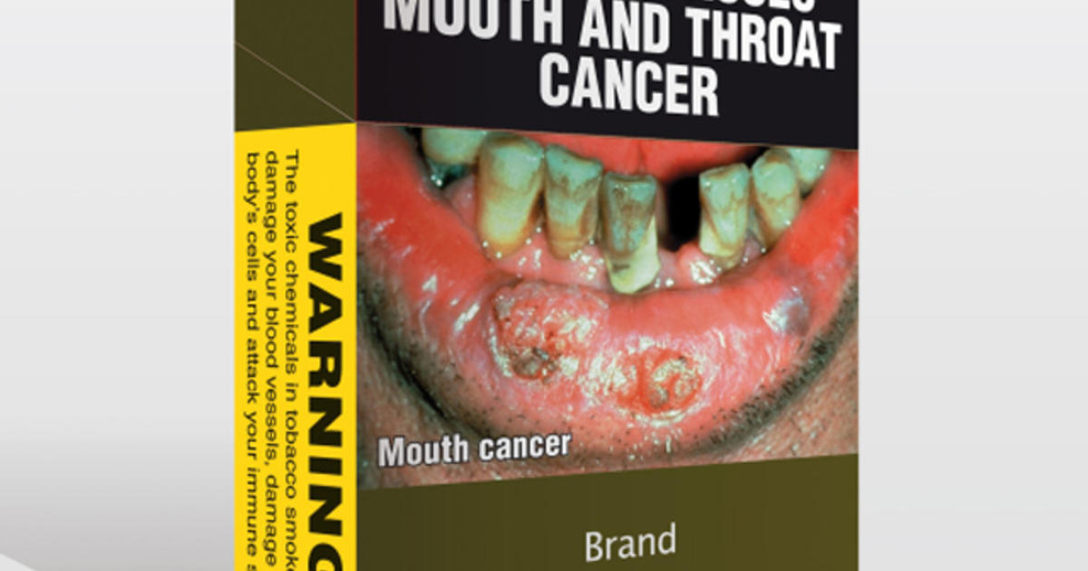 Australia's graphic tobacco warning labels