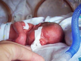 premature baby, preemie, hospital, birth, stock, 4x3
