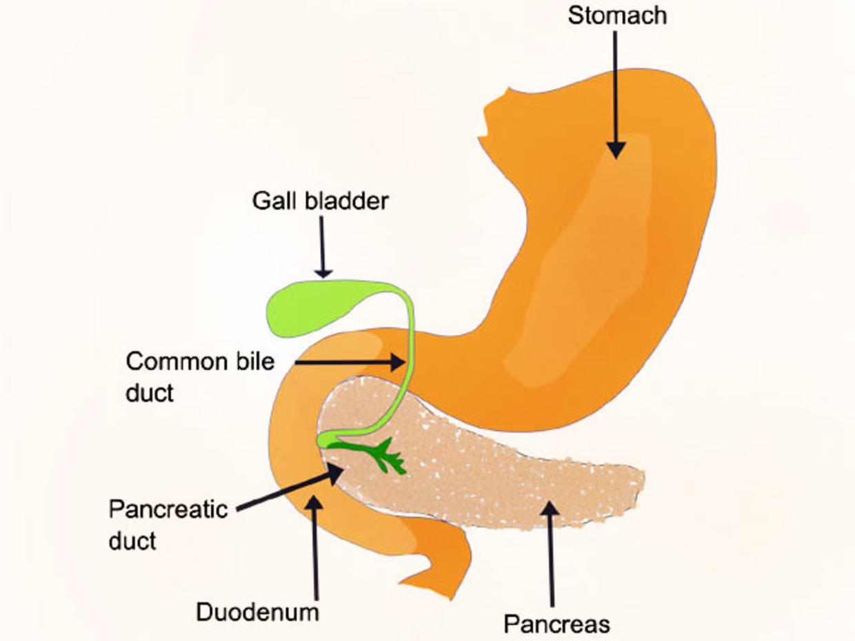 El pancrea se puede operar