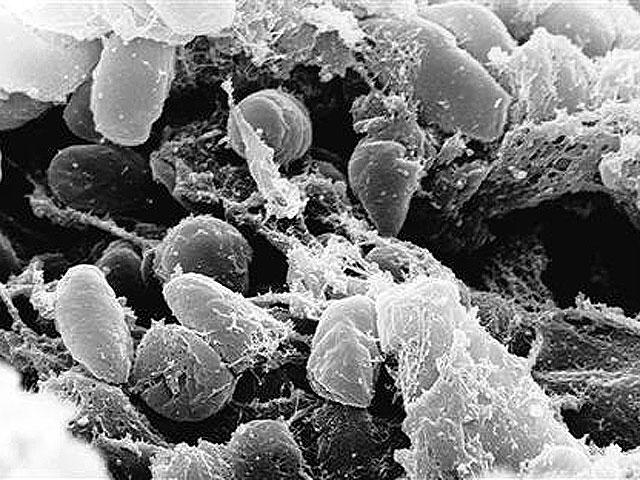 scientists crack genetic code of black death germ yersinia pestis cbs news black death germ yersinia pestis