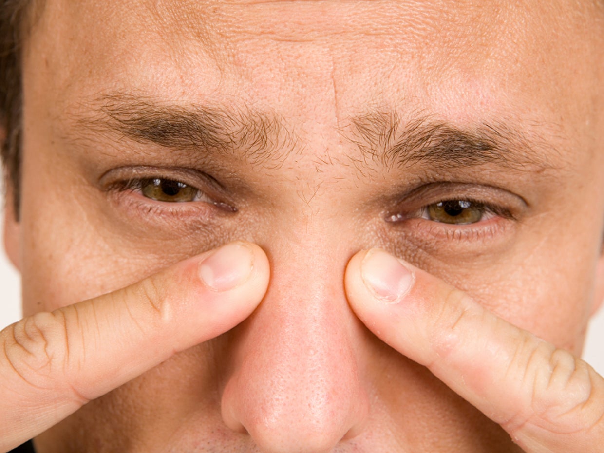 13 sneaky causes of sinus trouble CBS News