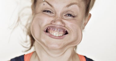 Pics of blown out faces go viral Pics of blown out faces go viral