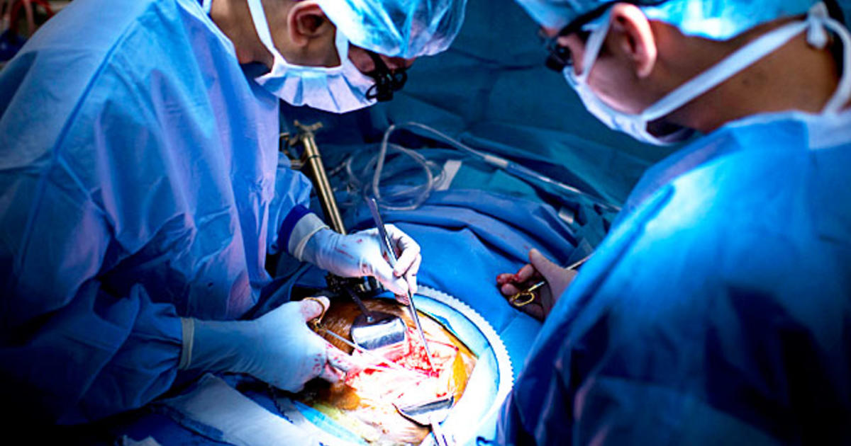 Inside look at kidney transplant (GRAPHIC IMAGES) CBS News