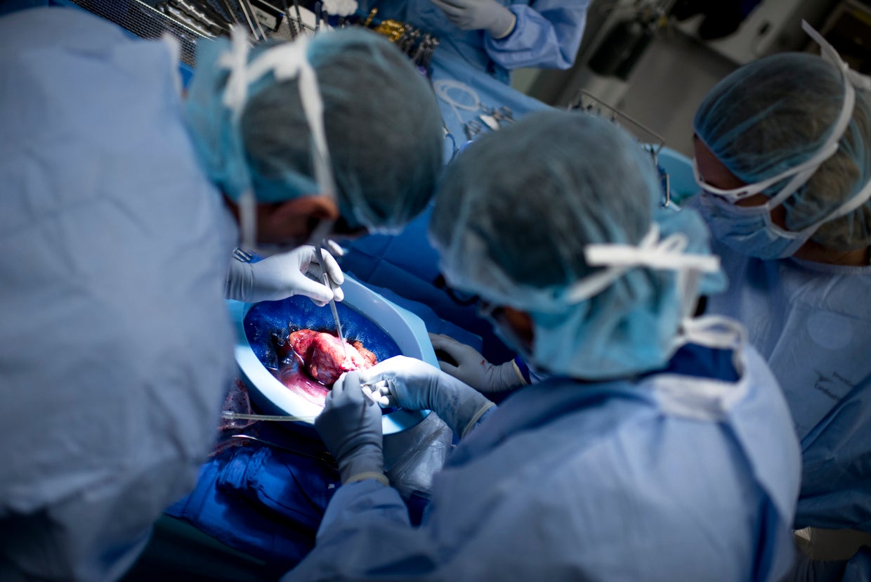 Inside look at kidney transplant (GRAPHIC IMAGES)