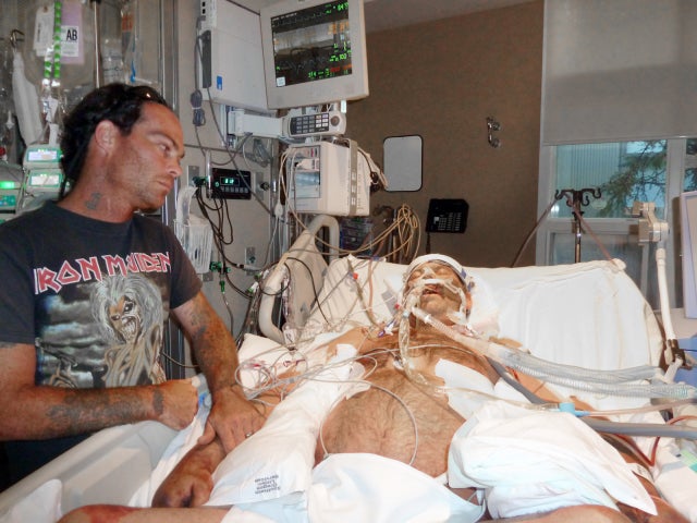 Ore Man Survives Black Death Plague Graphic Images Pictures