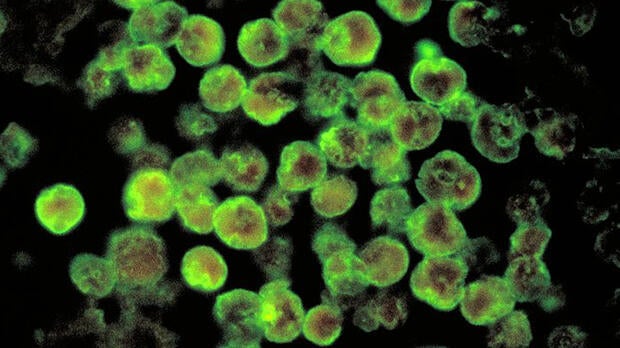 braineatingamoeba.jpg