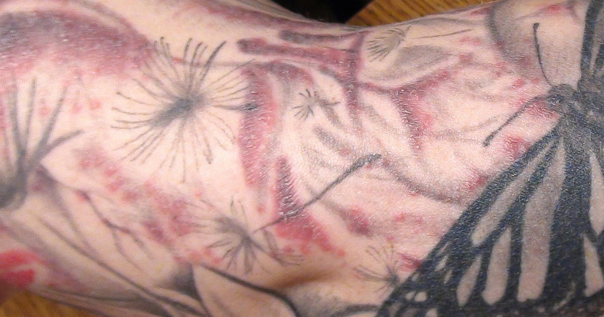 70 Free Tattoo Itchy HD Tattoo