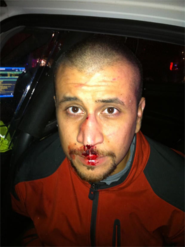 This photograph shows George Zimmerman, accused of killing unarmed teen Trayvon Martin, the night of their confrontation. It was made public by Zimmerman's lawyers on December 3, 2012.
