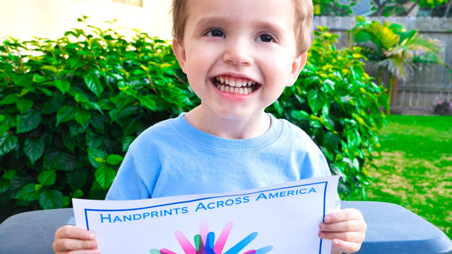 Giornata delle malattie rare: Impronte di mani in America