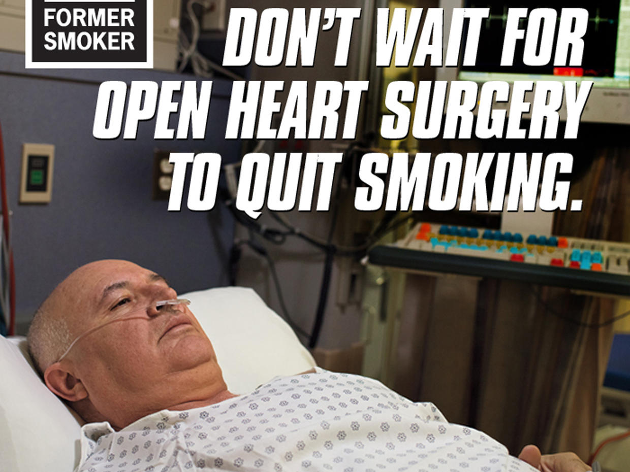 Cdc Unveils Latest Graphic Anti Smoking Ads In 2013 Tips From Former Smokers Campaign Cbs News 8360