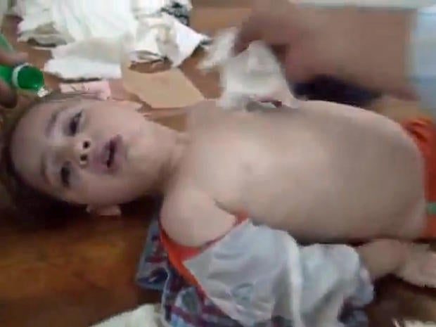 A young boy gasps for air in a makeshift hospital after an alleged chemical weapons attack on the eastern Ghouta suburbs of Damascus