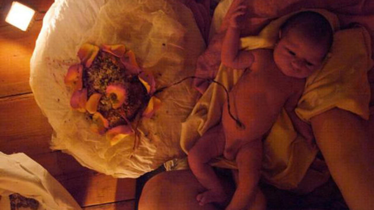 Lotus Birth Advocates Argue Against Cutting Umbilical Cord Cbs News