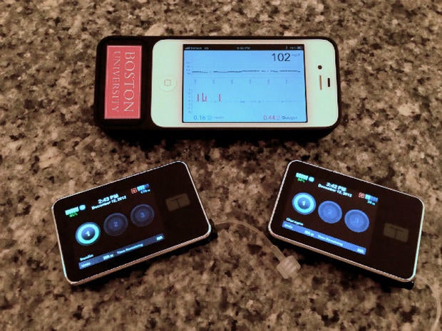 bionic-pancreas-1.jpg