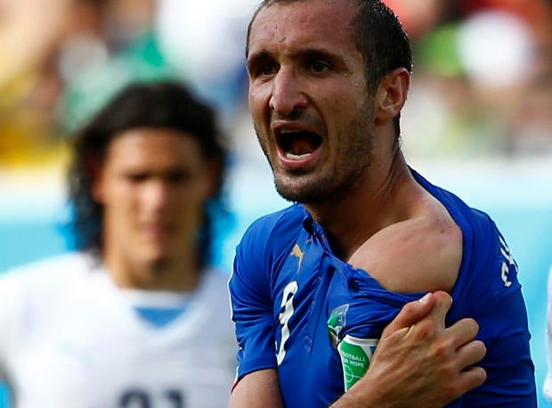 Italy's Giorgio Chiellini shows his shoulder, claiming he was bitten by Uruguay's Luis Suarez, during their 2014 World Cup Group D soccer match at the Dunas arena in Natal, Brazil on June 24, 2014