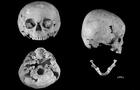 medieval-downs-syndrome-skulls-350-x-620.jpg 