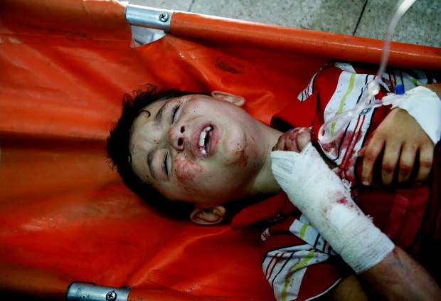 injuredboyap255337669715.jpg