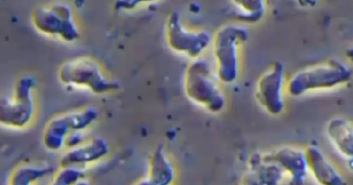 Killer amoeba found in Louisiana water system - CBS News
