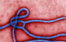 Dallas Ebola patient treated with experimental drug 