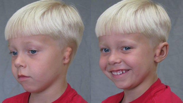 childear.jpg