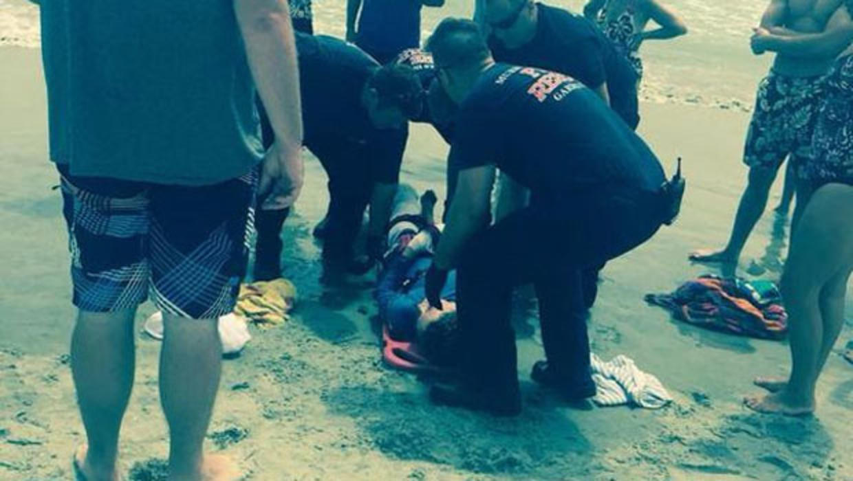 Teen Being Treated After Shark Attack In South Carolina CBS News   Sharkattacknc 