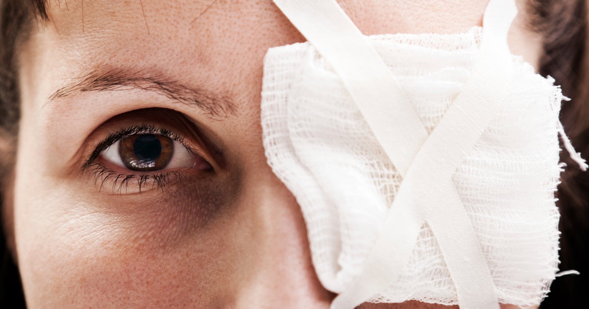 The most common causes of eye injuries in the U.S. - CBS News