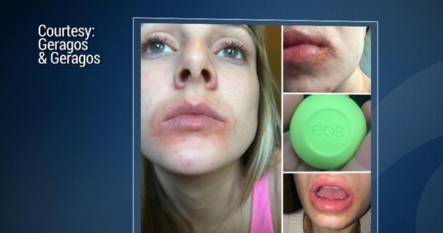 Chapstick Recall 2018 - chapstick Chapstick Recall 2018 - chapstick