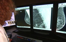 New guidelines recommend mammograms begin at age 50