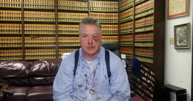Attorney James Crawford Face slammed into courthouse bench during