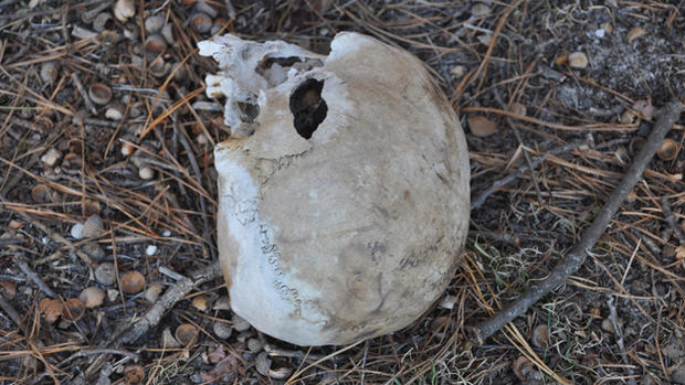 Skull Found In Brick Township 