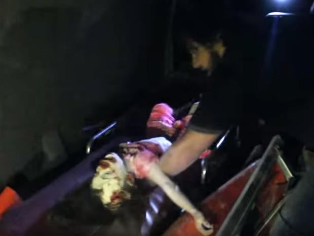 A young girl badly injured in an airstrike on the al-Quds hospital in southern Aleppo on April 28, 2016, being loaded into an ambulance