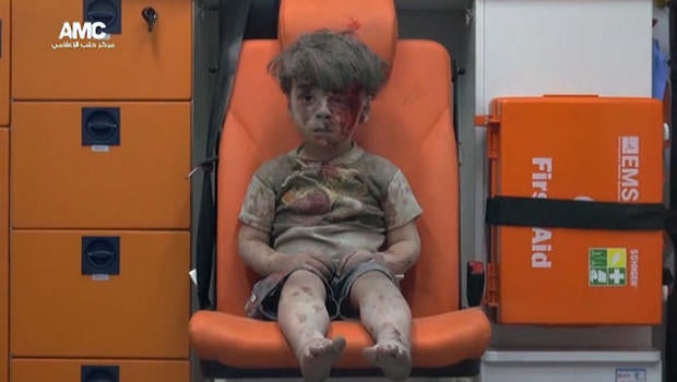 aleppo-injured-boy.jpg