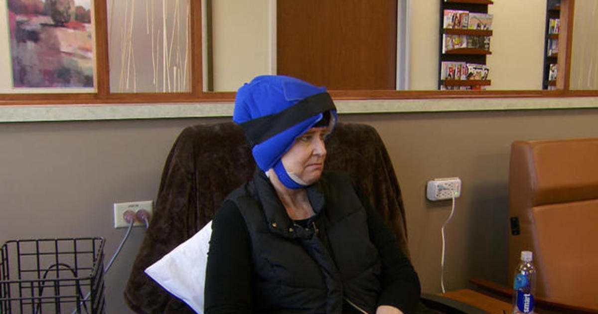 Cold caps help breast cancer patients save their hair 