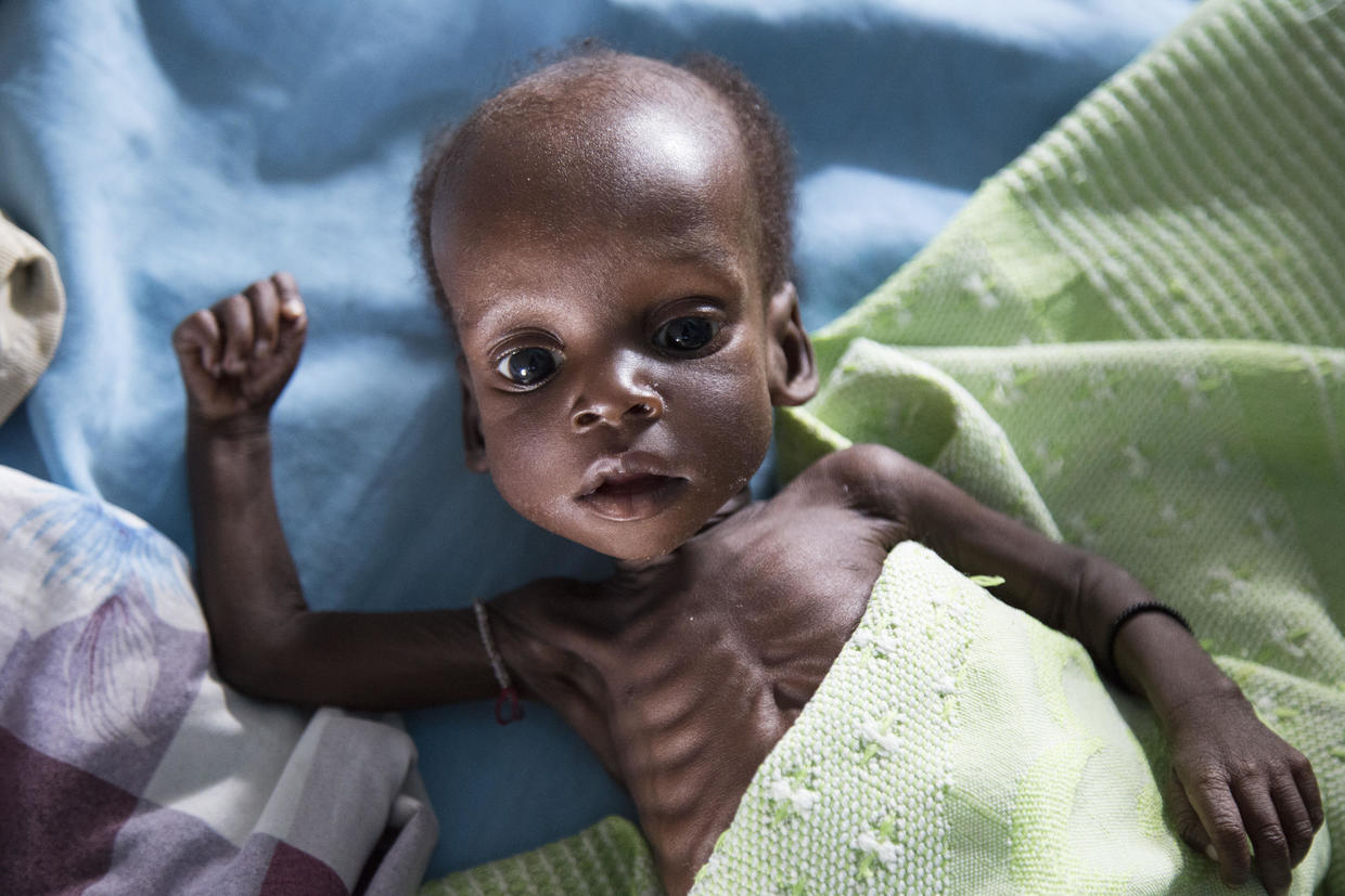 Famine Emergency Starving In South Sudan Pictures Cbs News