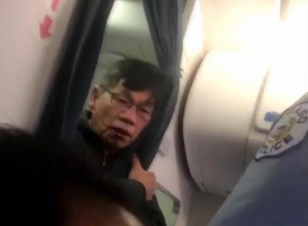 170411-facebook-united-passenger-bloody-face.jpg