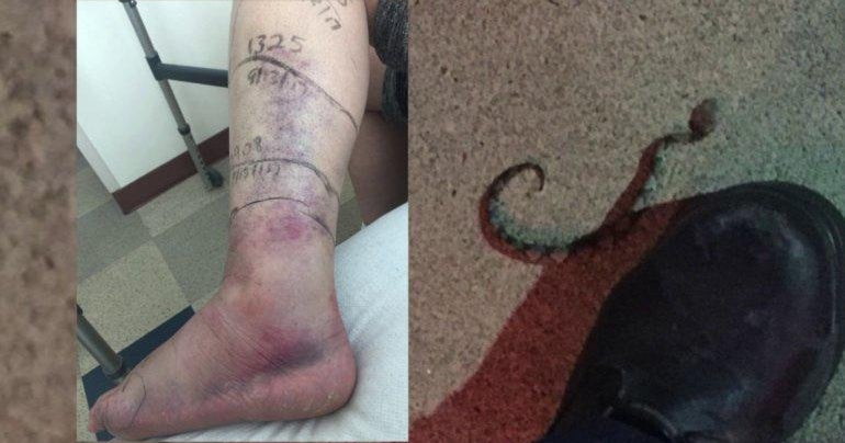 Insane Snake Attacks Warning Graphic Images Cbs News