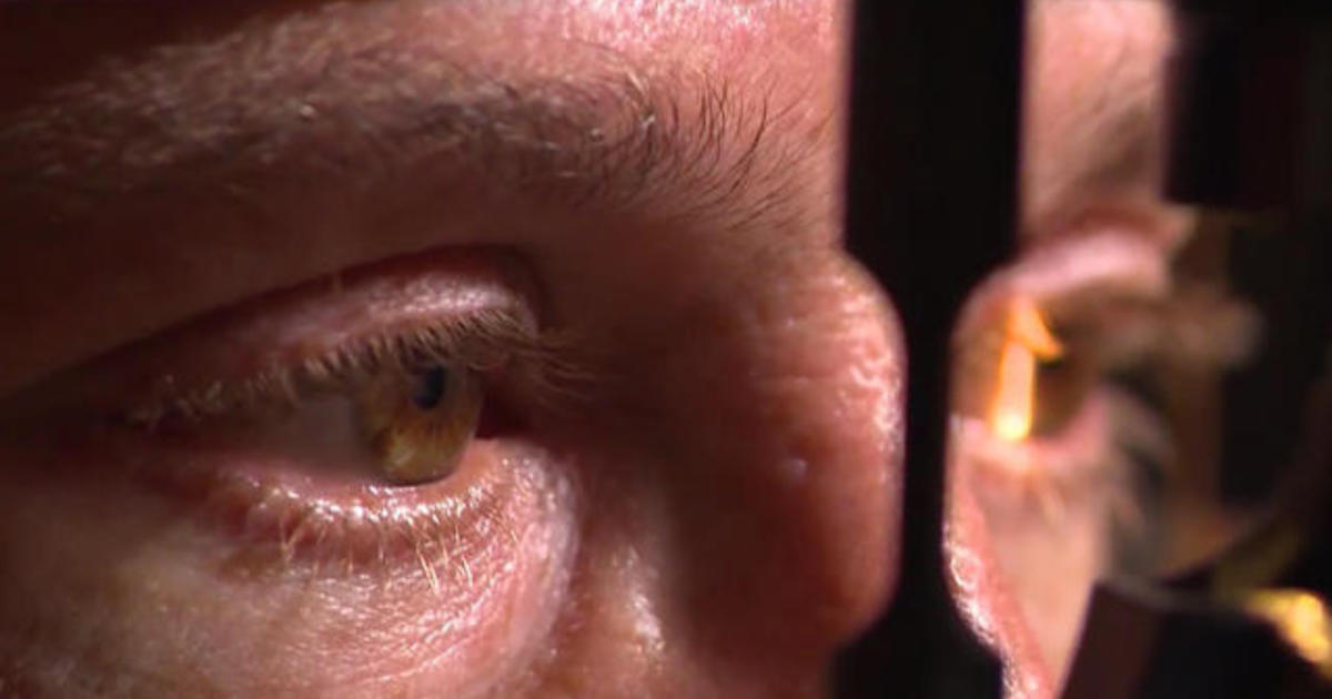 experimental-drug-tested-for-eye-stroke-victims-cbs-news