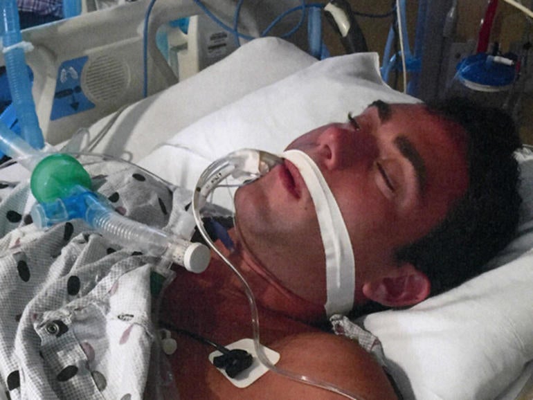 Jacob Nolan in a coma