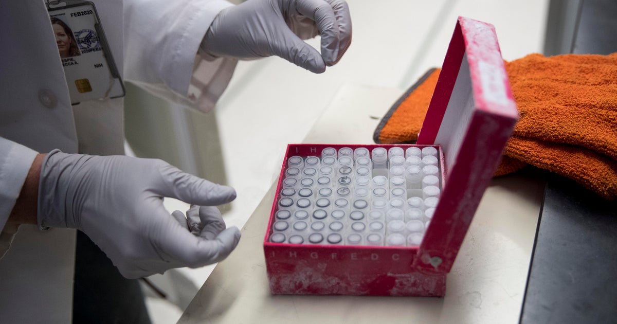 Millions earmarked for vaccine research was misappropriated, watchdog says - Vimarsana News