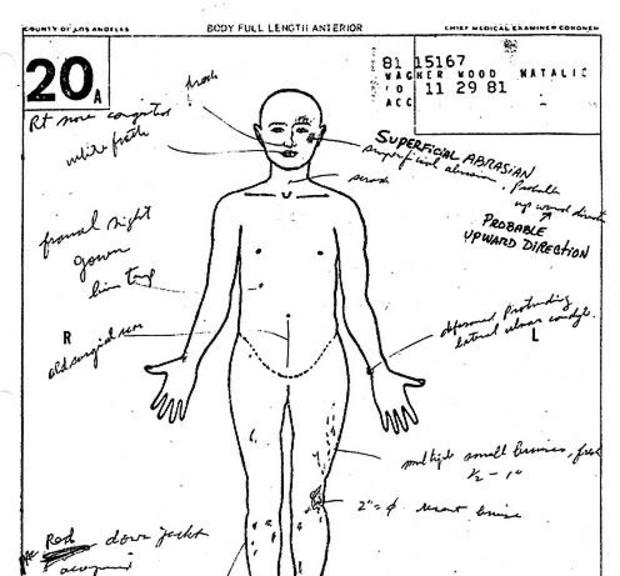 Natalie Wood autopsy report 