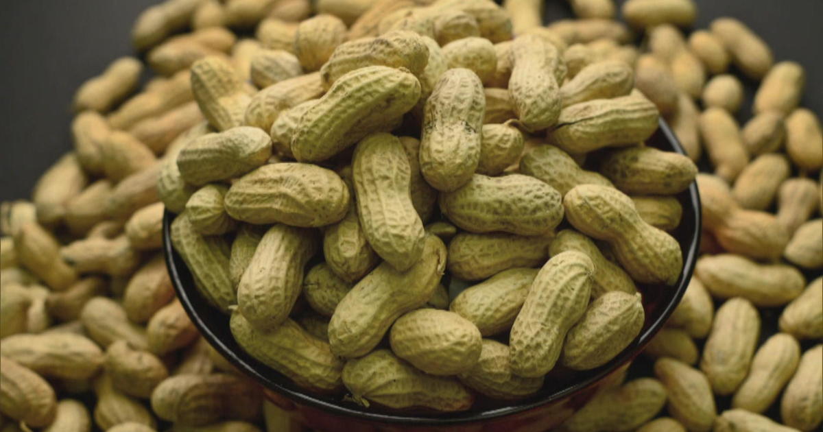 Peanut Allergy Cured In Majority Of Children In Life 