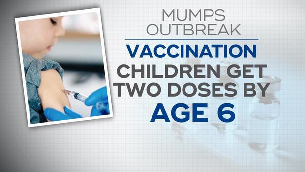 0321-en-lapook-mumps.jpg